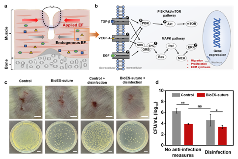 手术缝合线是什么材料东华大学与上海市第六人民医院等单位合作在智能纤维用于可吸收自放电手术缝合线方面取得新进展_https://www.jmylbn.com_新闻资讯_第6张