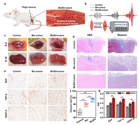 手术缝合线是什么材料东华大学与上海市第六人民医院等单位合作在智能纤维用于可吸收自放电手术缝合线方面取得新进展_https://www.jmylbn.com_新闻资讯_第5张