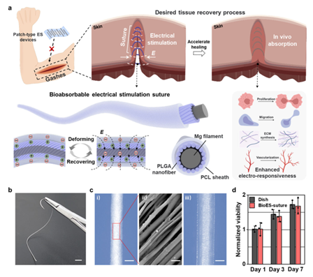 手术缝合线是什么材料东华大学与上海市第六人民医院等单位合作在智能纤维用于可吸收自放电手术缝合线方面取得新进展_https://www.jmylbn.com_新闻资讯_第2张